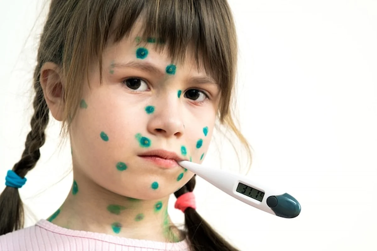 Dziewczynka z zielonymi wysypkami na twarzy, trzymająca termometr z gorączką