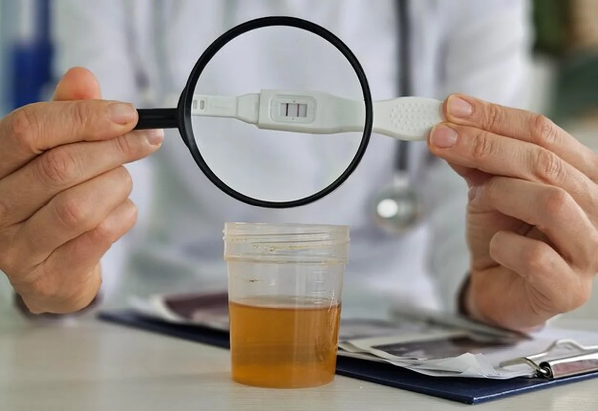 Lekarz ginekolog bada wyniki moczu szkłem powiększającym i pozytywnym testem ciąży